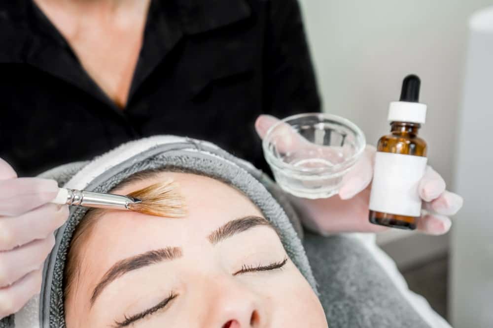 Woman with chemical peel treatment being applied to forehead