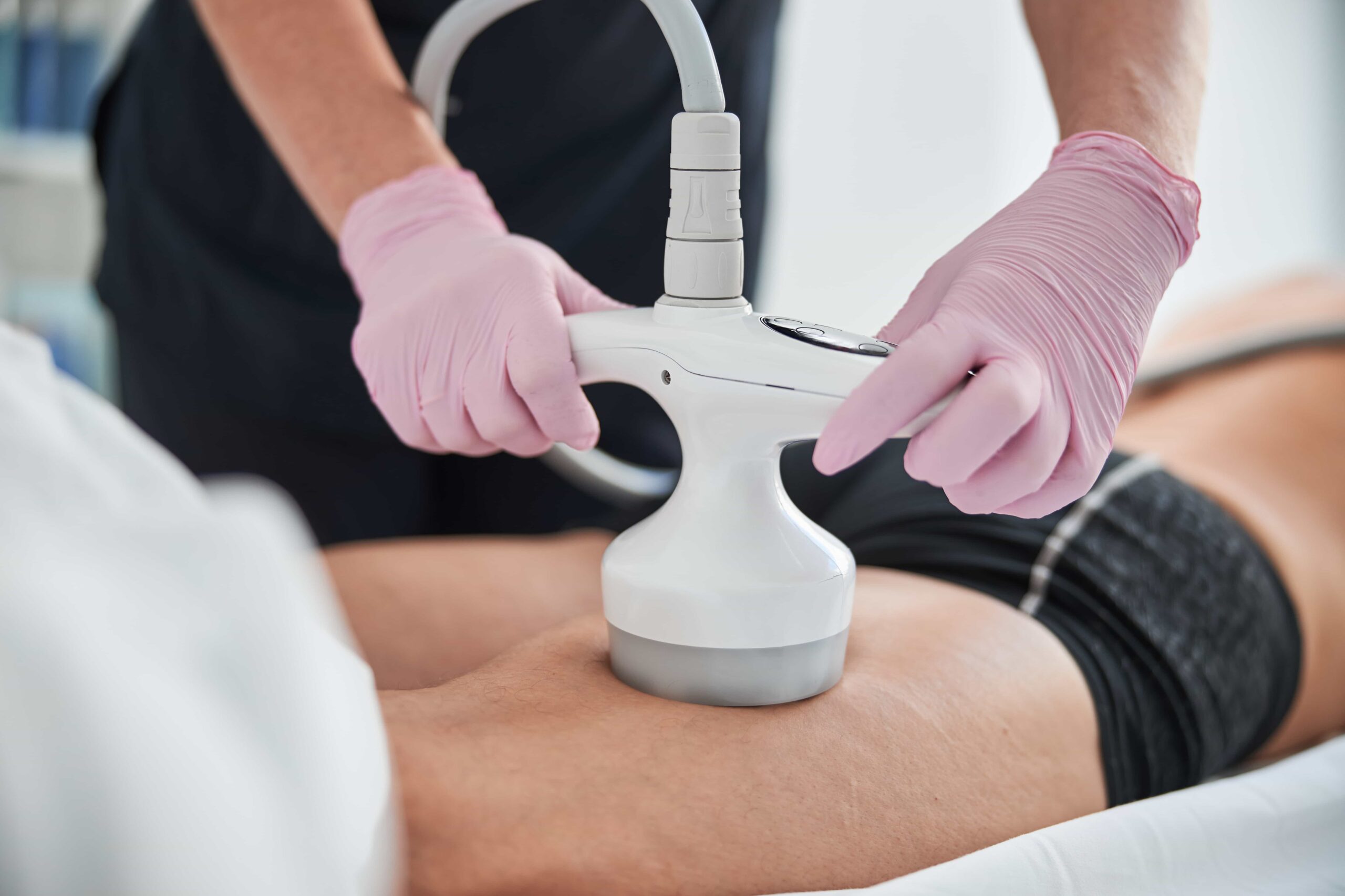 Treatment of cellulite using radio frequency 